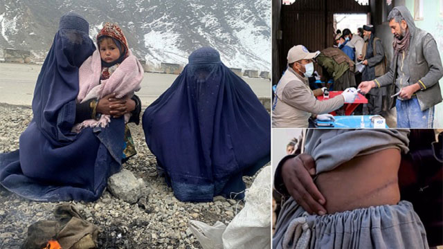 ছবি : সংগৃহীত